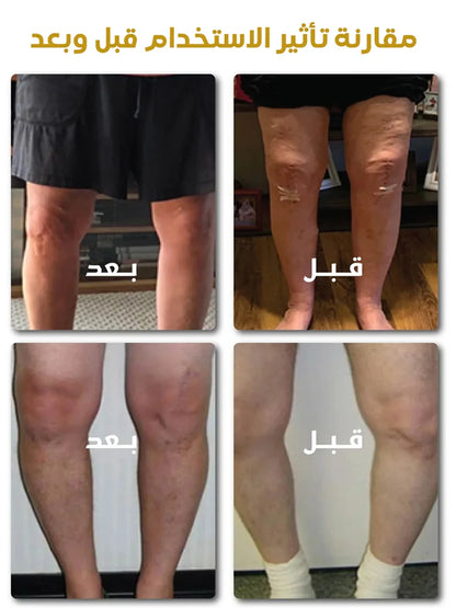 كريم العناية بالمفاصل