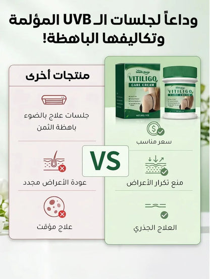 لا داعي لإخفاء البقع البيضاء بالمكياج بعد اليوم!