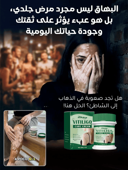 لا داعي لإخفاء البقع البيضاء بالمكياج بعد اليوم!