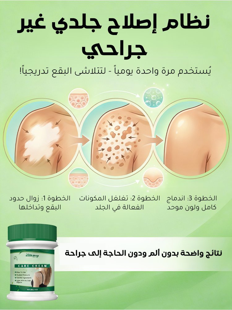 لا داعي لإخفاء البقع البيضاء بالمكياج بعد اليوم!
