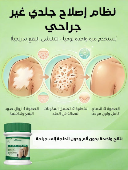 لا داعي لإخفاء البقع البيضاء بالمكياج بعد اليوم!